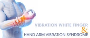 hand arm vibration syndrome (HAVS)